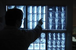 Read more about the article Intel and Philips Accelerate Deep Learning Inference on CPUs in Key Medical Imaging Uses